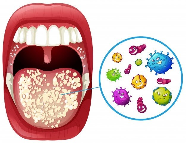 oral hygiene